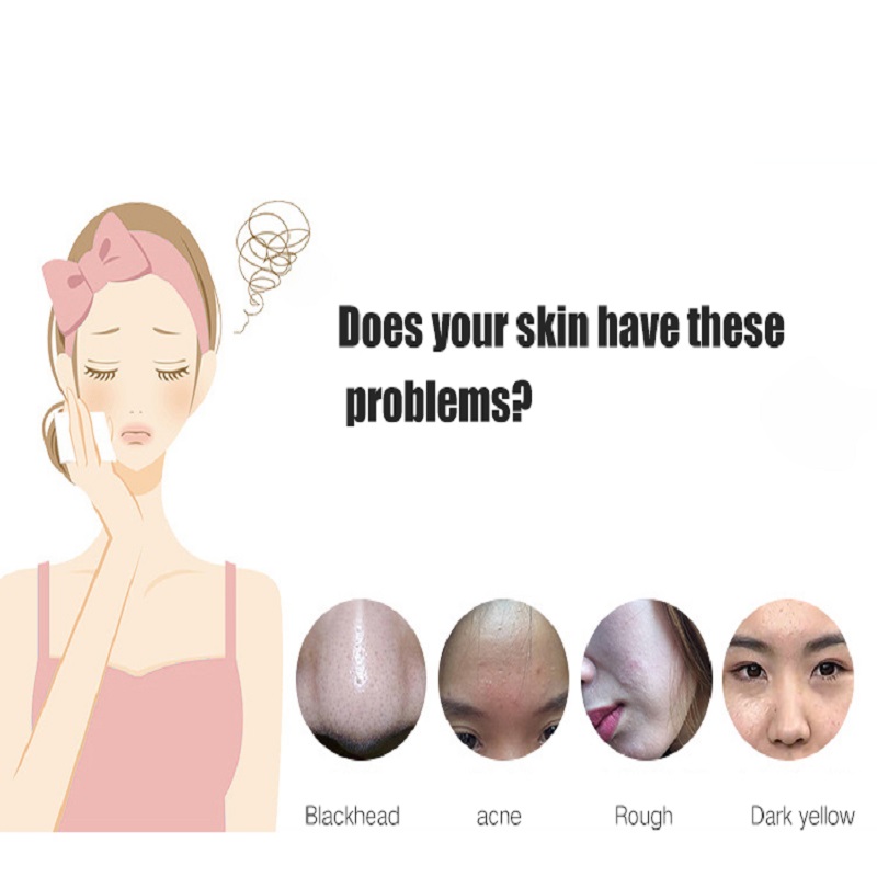 Deep Cleansing Exfoliators Skin Foryngelse Face Lift Facial Ultrasonic Skin Scrubber