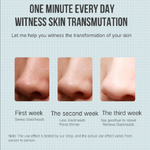 Elektrisk extractor acne fjernelse blackhead remover vakuum skønhed maskine pore renere