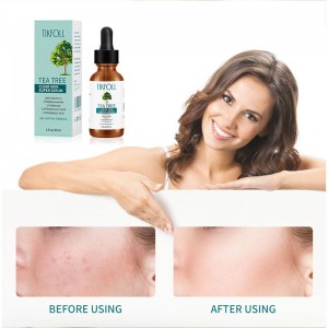 Tea Tree Serum