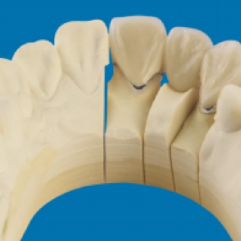 Metal-Porcelænstænder