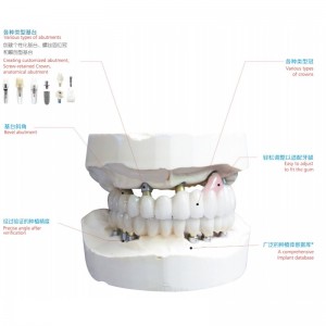 Dentalimplantat