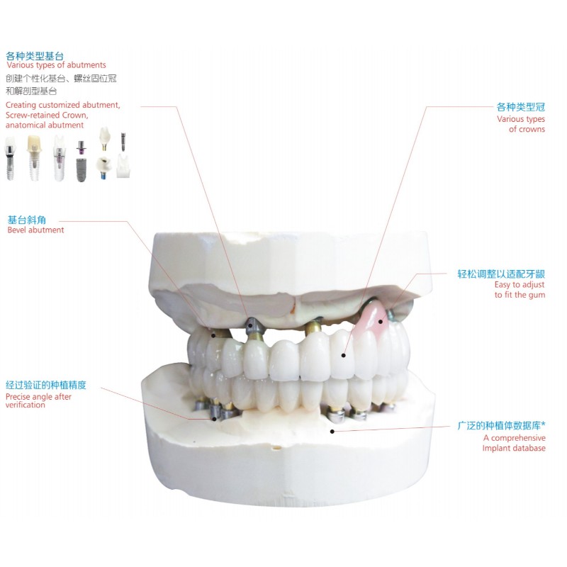Dentalimplantat